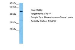 CABYR Antibody, Novus Biologicals 100 &mu;L | Buy Online | Novus Biologicals | Fisher Scientific